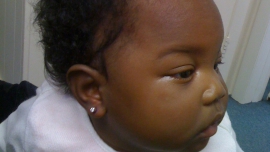 Pierced ear of an infant (Courtesy guardian.ng)